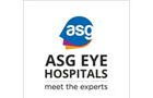 ASG